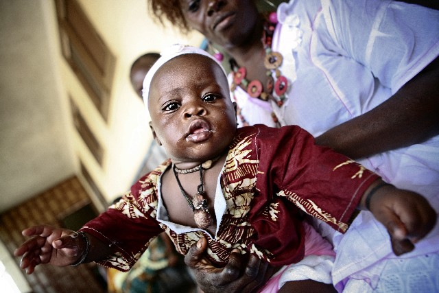 Aids in Guinea Bissau. Reportage by Giampaolo Musumeci